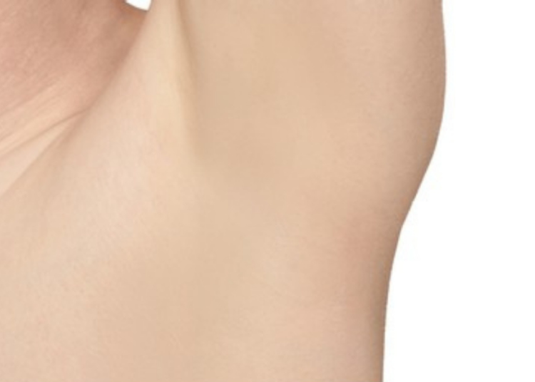 Laser Hair Removal in Dubai