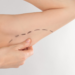 Brachioplasty