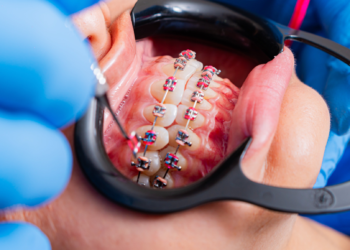 orthodontic treatment