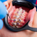 orthodontic treatment
