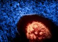 Colorized electron micrograph of a measles virus particle, released by NIAID in 2024