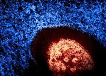 Colorized electron micrograph of a measles virus particle, released by NIAID in 2024
