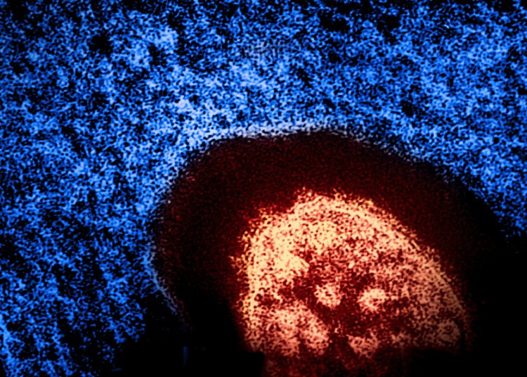 Colorized electron micrograph of a measles virus particle, released by NIAID in 2024