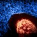 Colorized electron micrograph of a measles virus particle, released by NIAID in 2024