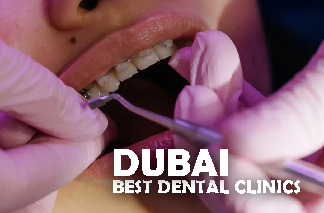 Best Dental Clinics In Dubai UAE
